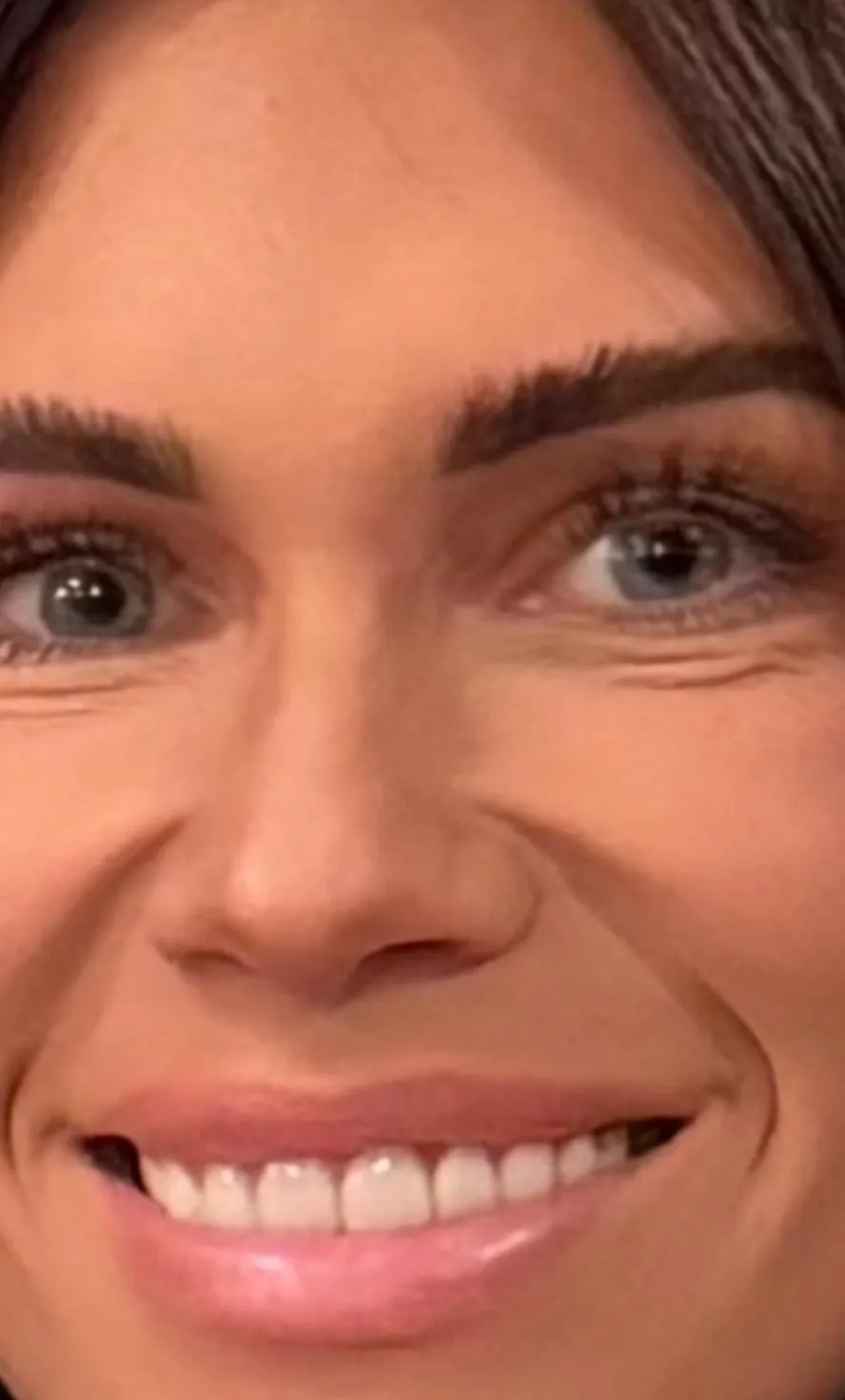 Jessi Ngatikaura Gives an Update After Her Eyelid Surgery and Shares Before and After Pics