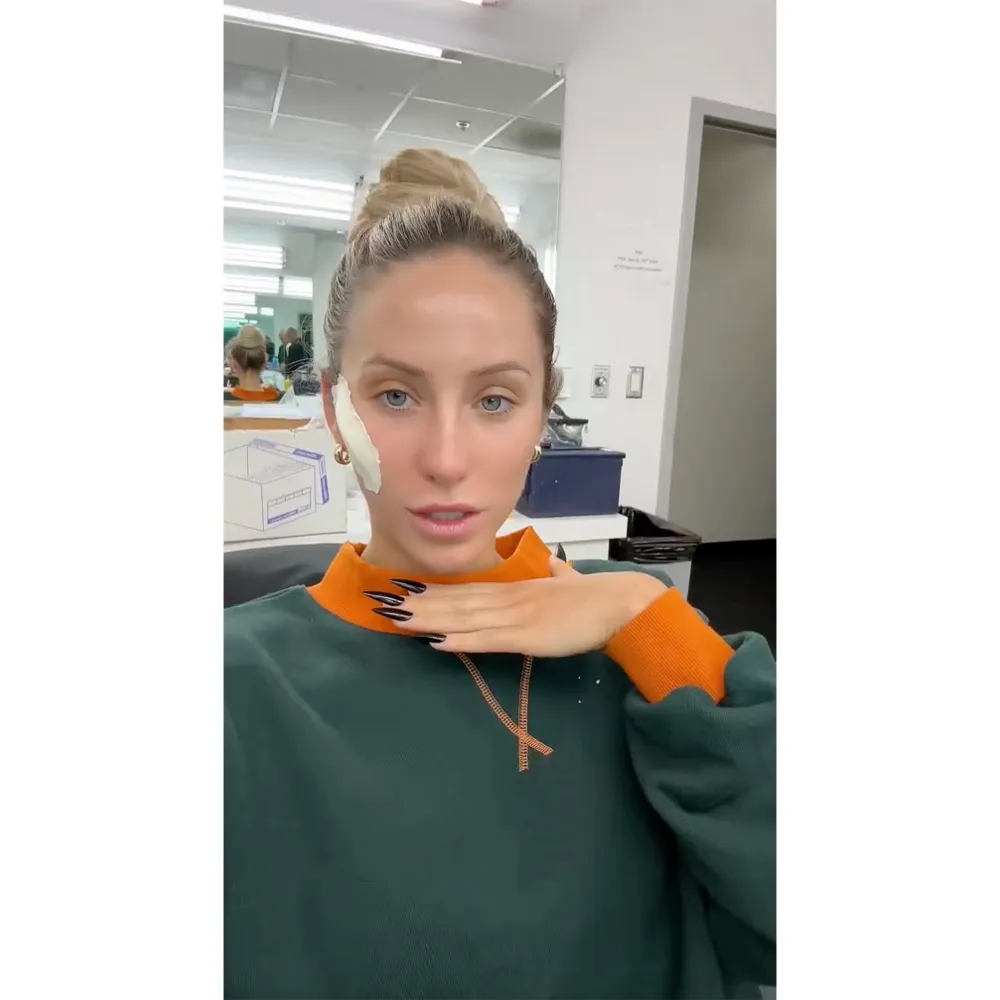 Alix Earle Explains Why She Removed Her Prosthetic Cheeks on DWTS