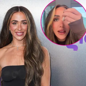 Ariana Biermann Claims Mom Kim Zolciak Had Her Freckles Lasered Off at 14- I Am Constantly Stamping Them On GettyImages-2235103558