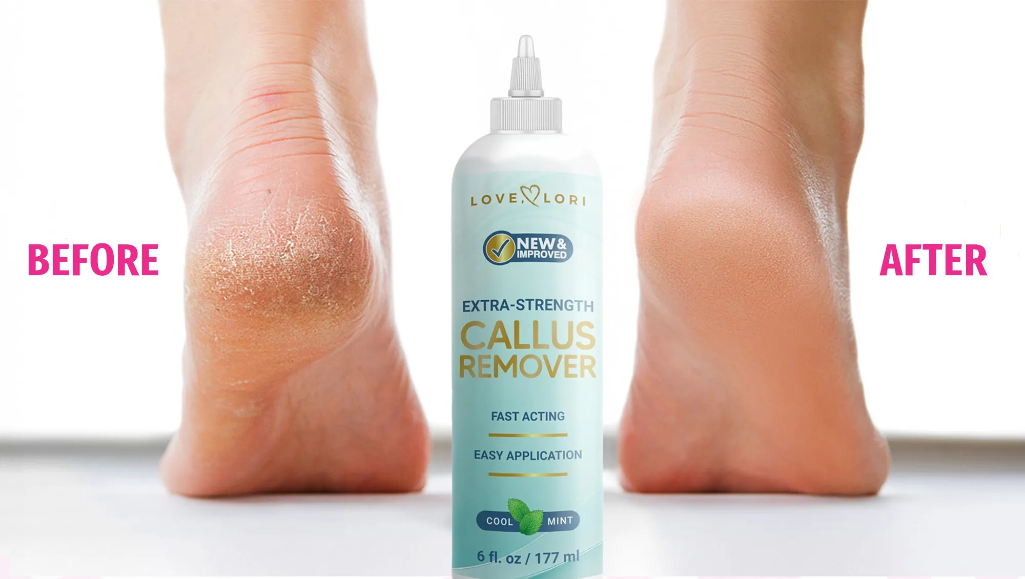 Callus Remover