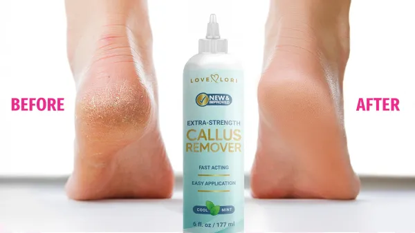 Callus Remover