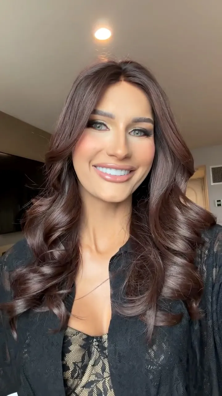 Miss USA Contestant With Alopecia Ditches Wig, Walks Runway Without Hair