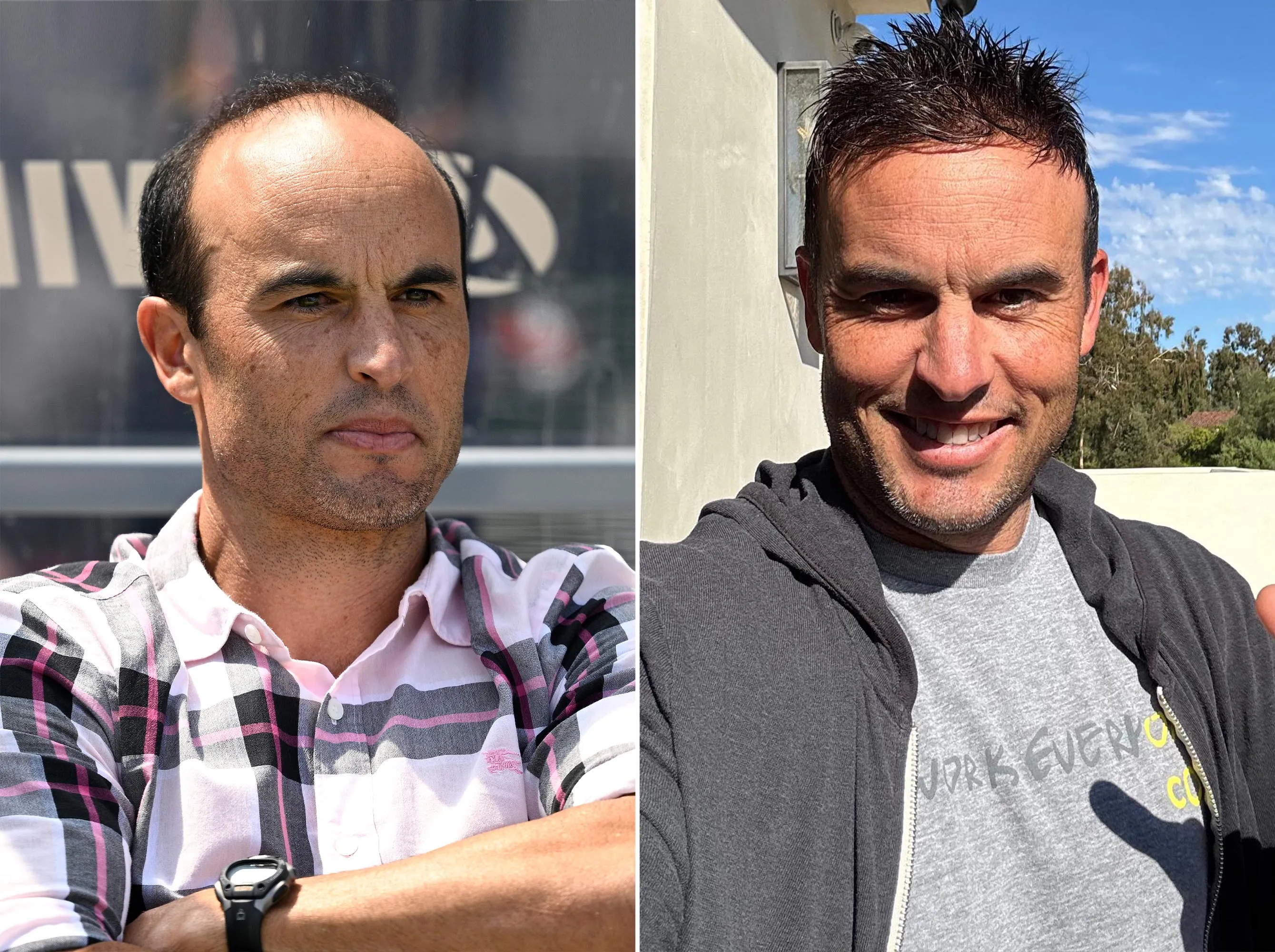 Soccer Star Landon Donovan Discusses Insane Reaction to His New Hairpiece 2168273570