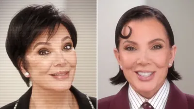 The Kardashians Season 7 Shows Before and After of Kris Jenner Facelift