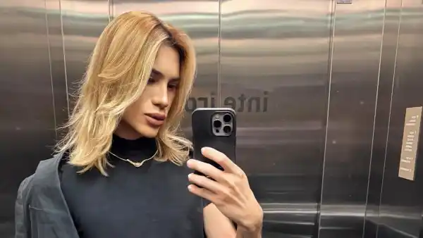 Influencer Dies at Age 31 After Experiencing Complications from Cosmetic Procedure: Report