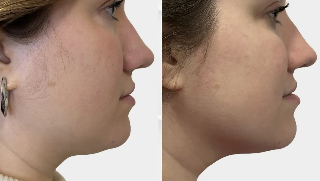 SickScience Labs Shapeshift Serum