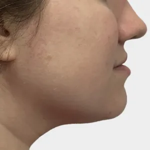 SickScience Labs Shapeshift Serum