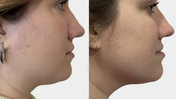 SickScience Labs Shapeshift Serum