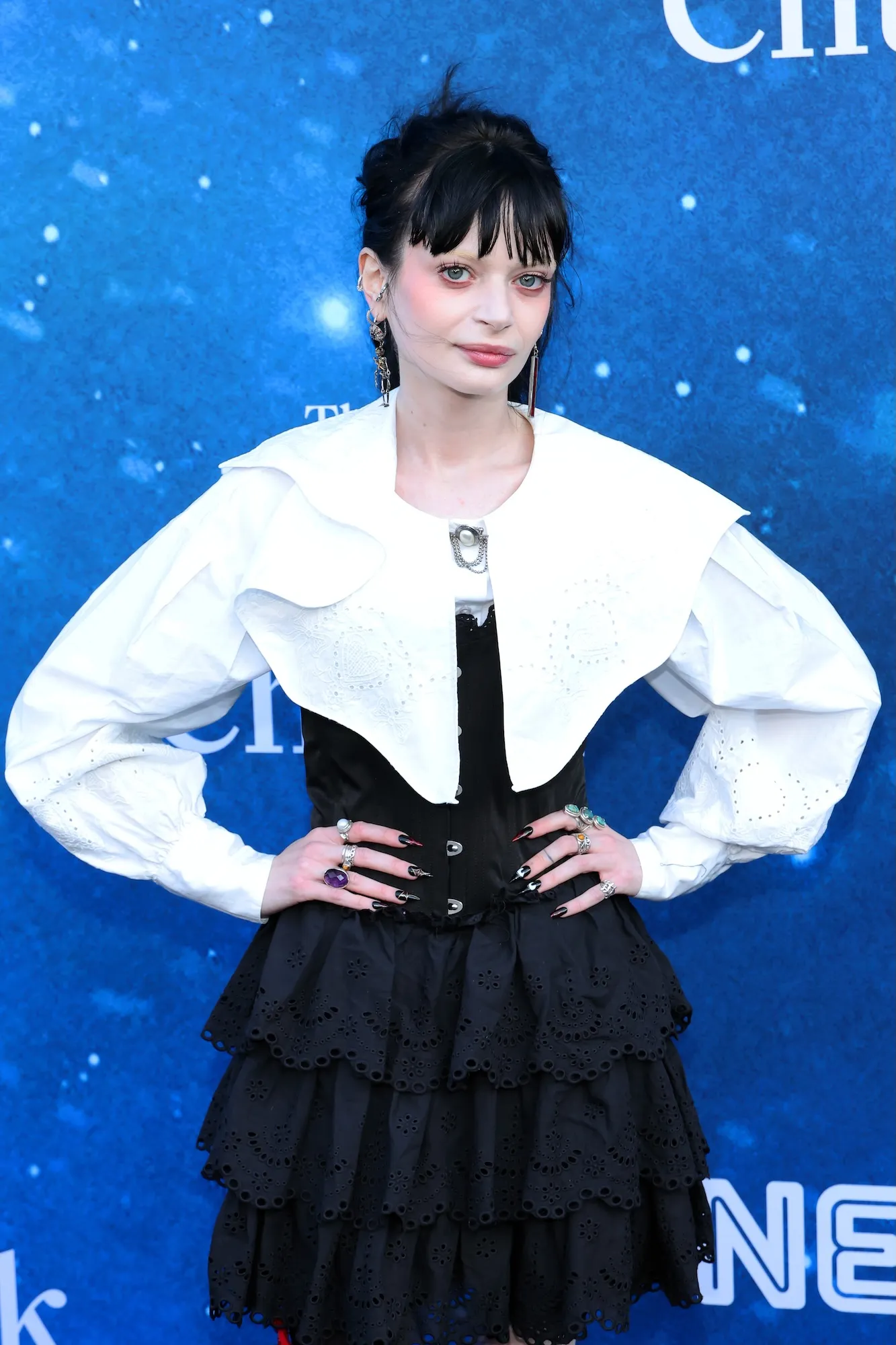 'Celebrity Traitors UK' Star Ruth Codd Undergoes 2nd Leg Amputation at 29