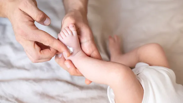 Tubby Todd All Over Ointment on Sale During Amazon's Cyber Sale