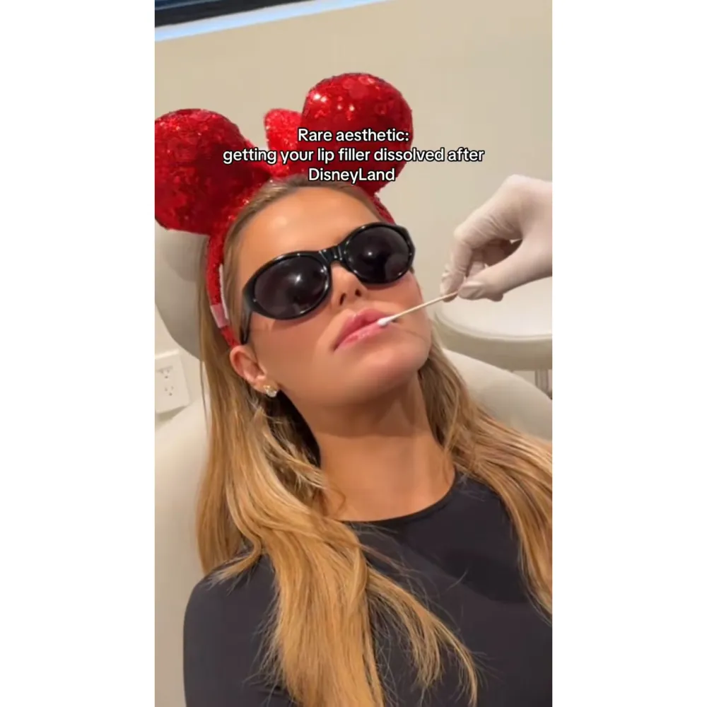 Brooks Nader Gets All Of Her Lip Filler Dissolved at Disneyland TikTok