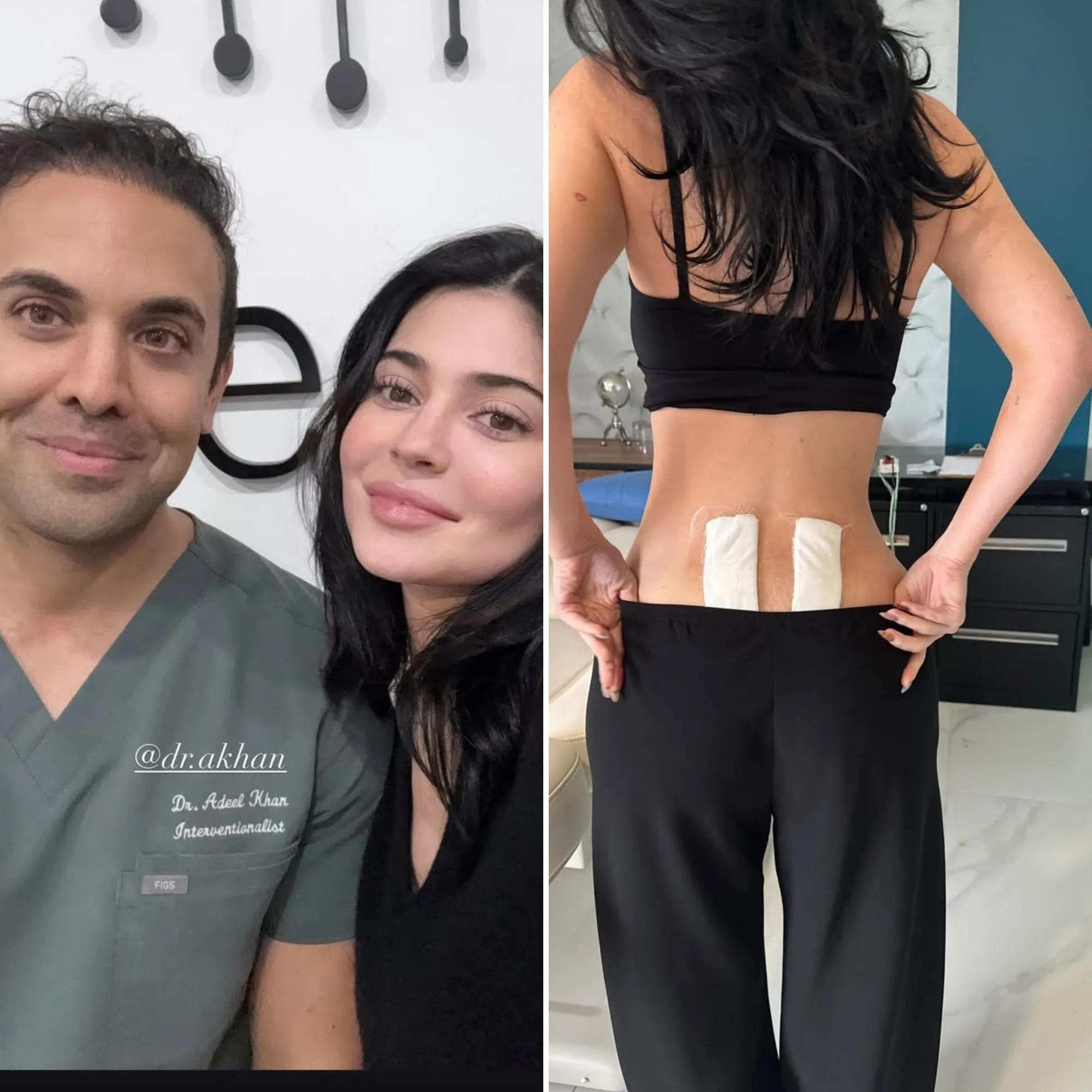 Kylie Jenner Undergoes Stem Cell Therapy for 'Chronic Back Pain'