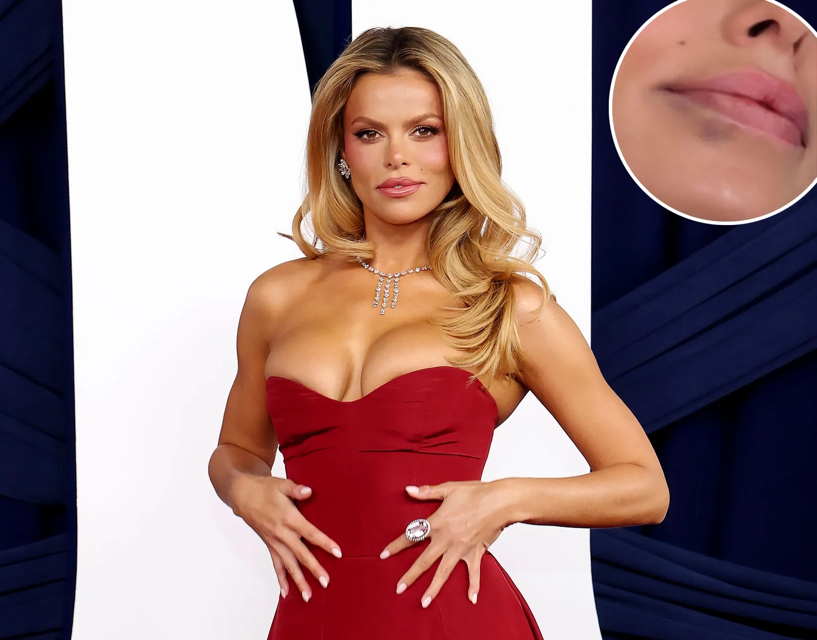 Promo Brooks Nader Gets All Of Her Lip Filler Dissolved at Disneyland