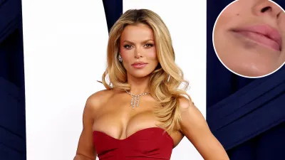 Promo Brooks Nader Gets All Of Her Lip Filler Dissolved at Disneyland