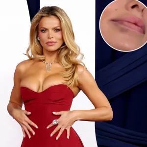 Promo Brooks Nader Gets All Of Her Lip Filler Dissolved at Disneyland