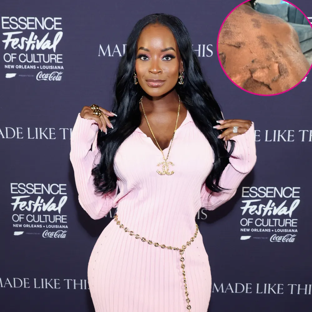 RHOA s Shamea Morton Sues Over Chemical Burn Gone Wrong