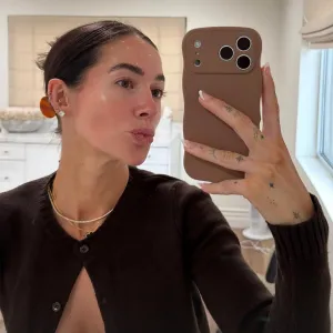 Avery Woods Gets Botox For 1st Time in a Year