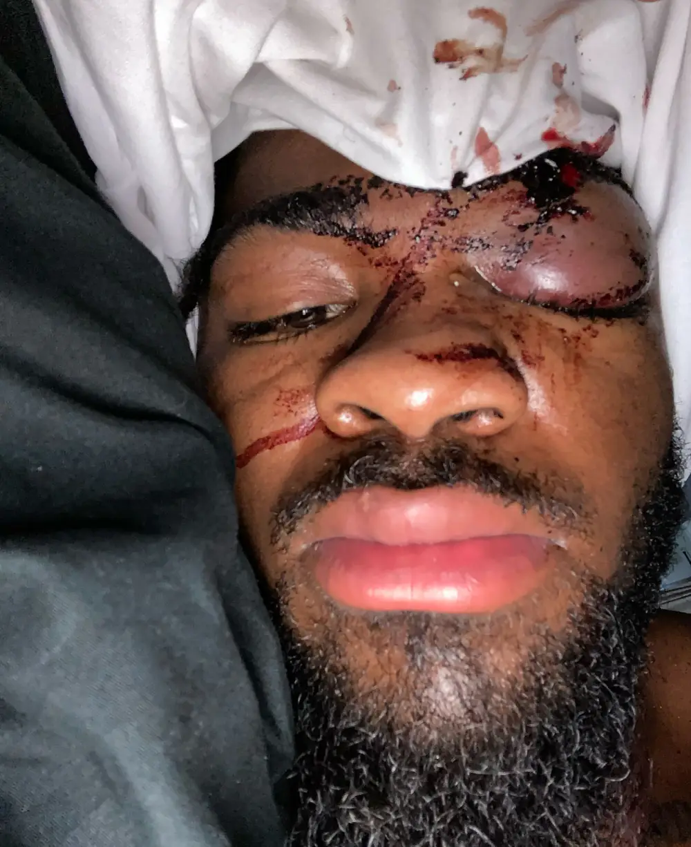 Blac Chyna Accuses Ex Of Abuse