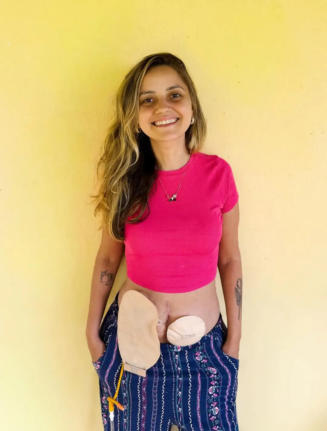 Influencer Jessica Daugirdas Dead at Age 35 After Being Hospitalized for Sepsis Amid Cancer Battle