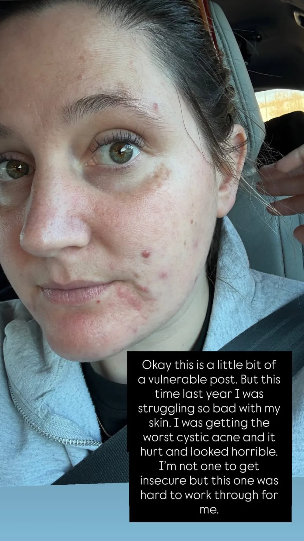 Tori-Roloff-Skin-1_3802143633102260992