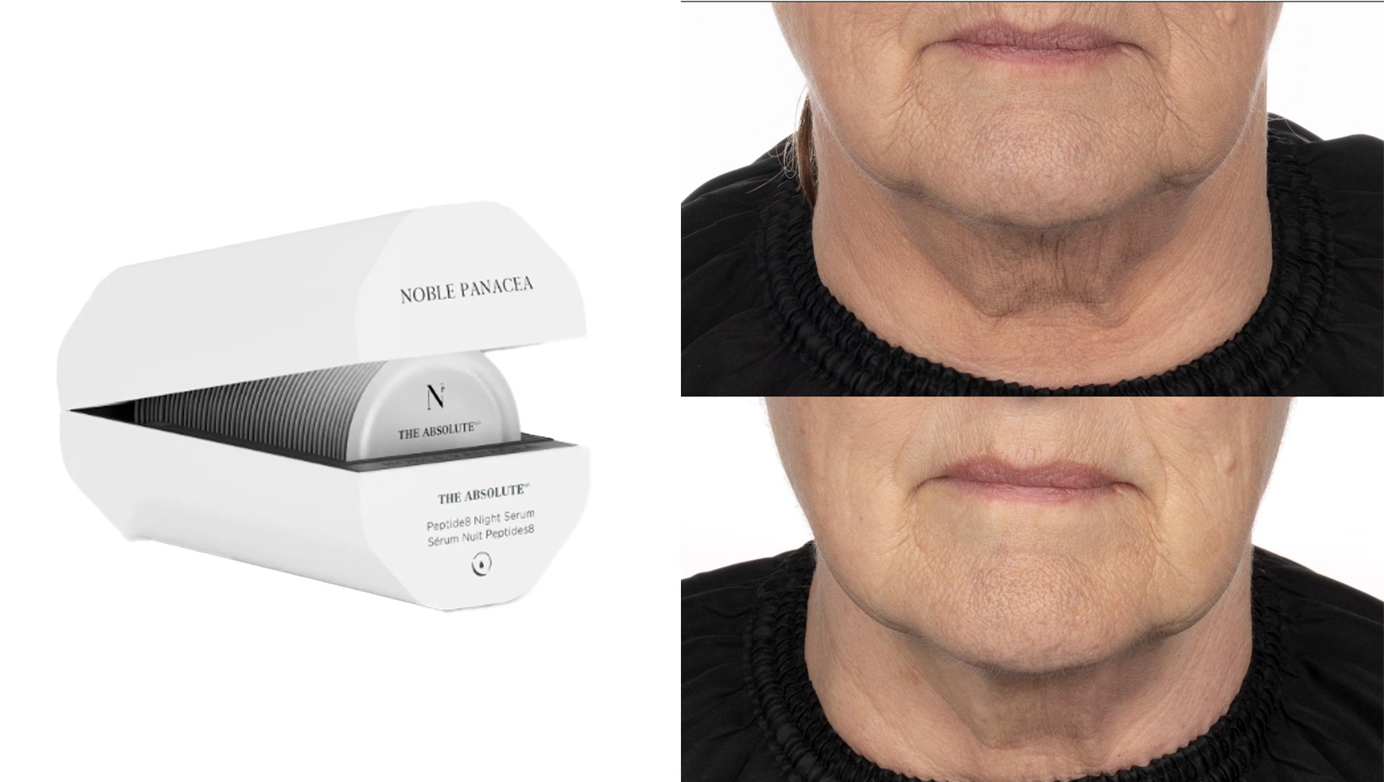 Noble Panacea Before and After