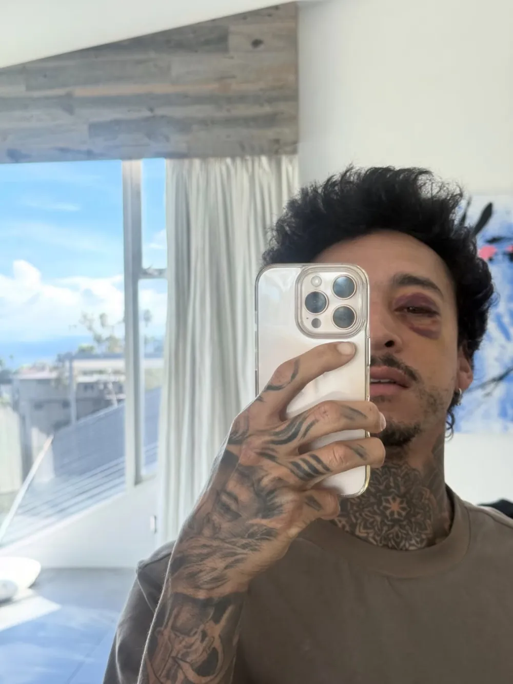 Olympic Skateboarder Nyjah Huston Suffers Fractured Skull After Death Defying Stunt