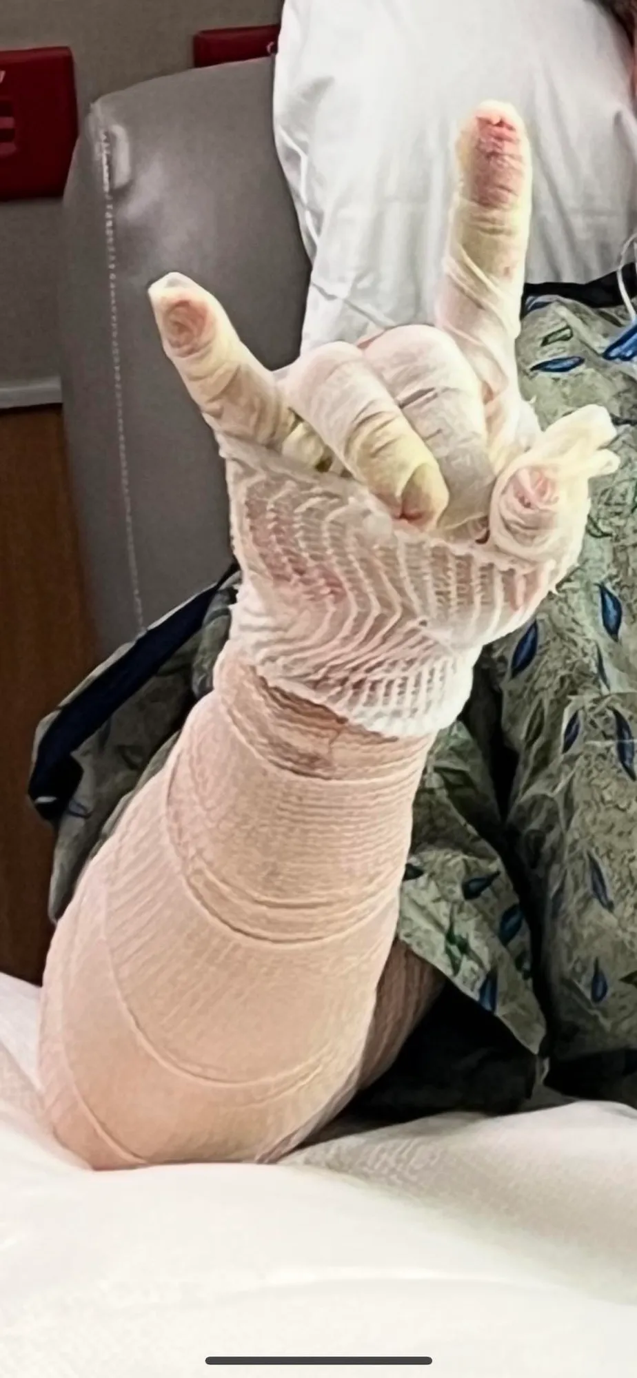 Former Texas WR Jordan Shipleys Wife Posts Update About His Facial Burns