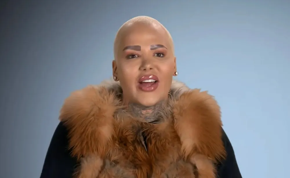 Botcheds Jordan James Parke Dies After Possible Cosmetic Procedure Amid 2 Arrests on Suspicion of Manslaughter