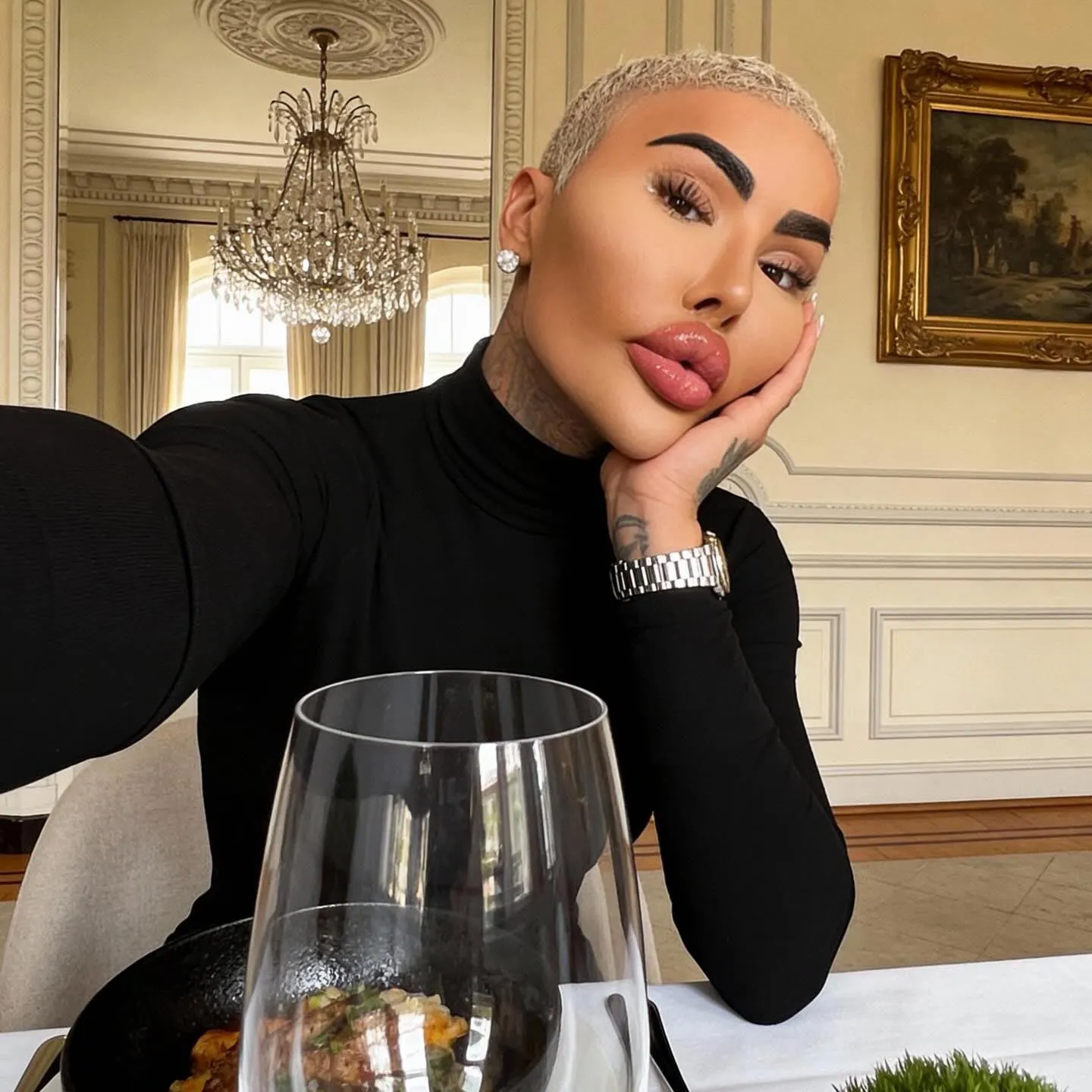 Botcheds Jordan James Parke Dies After Possible Cosmetic Procedure Amid 2 Arrests on Suspicion of Manslaughter