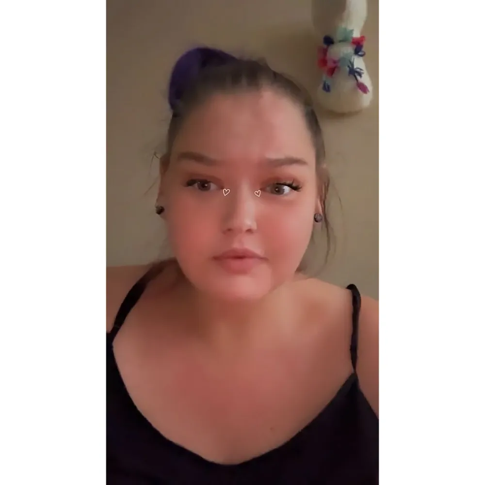 Amy Slaton Shows Off Results After Surgery to Correct Her Lazy Eye