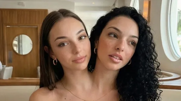 Feature Who Are Valeria and Camila The Real Story Behind Viral Conjoined Twins