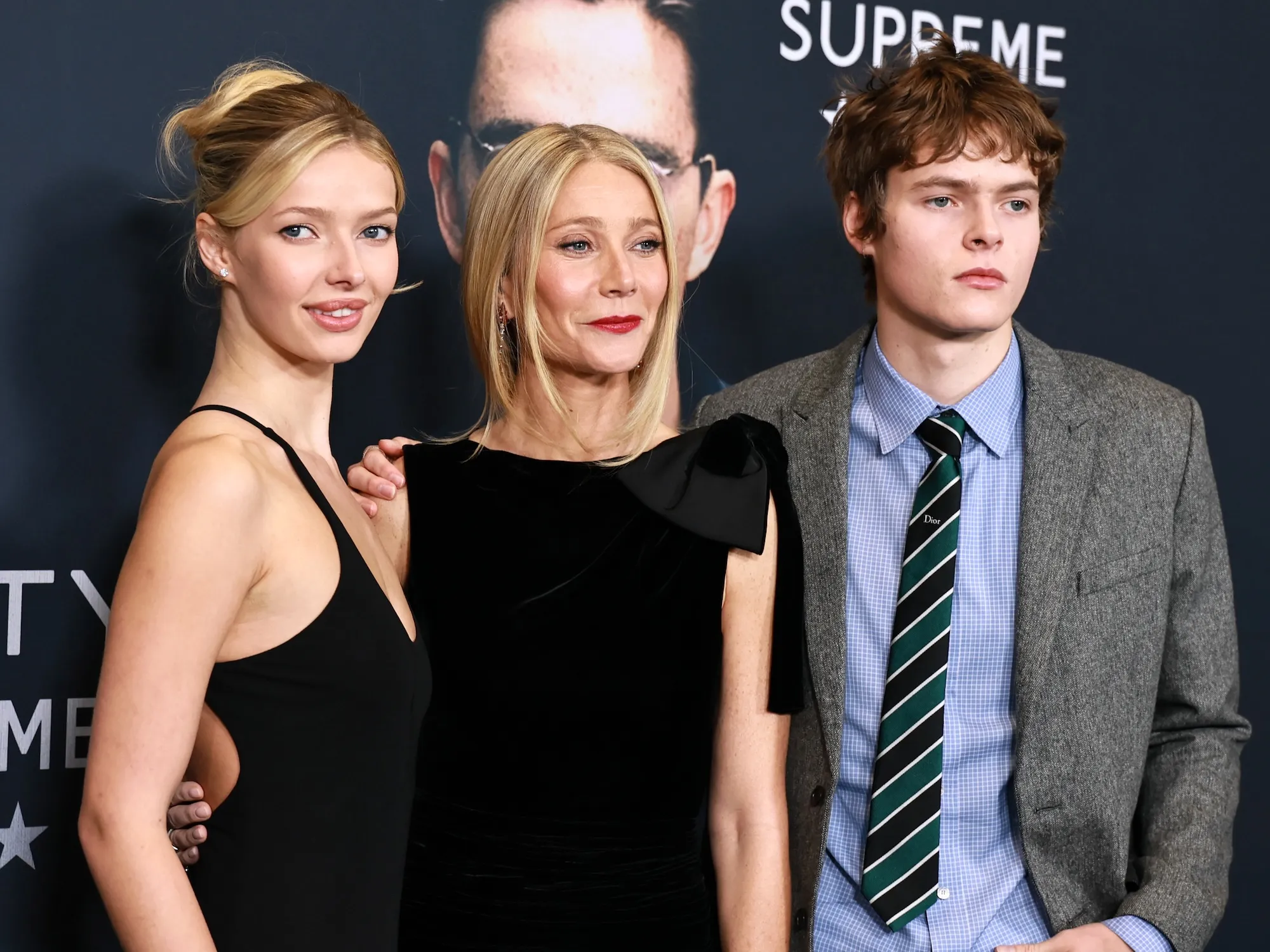 GettyImages-2252278134 apple martin lip filler