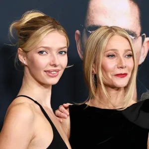 GettyImages-2252278134 apple martin lip filler