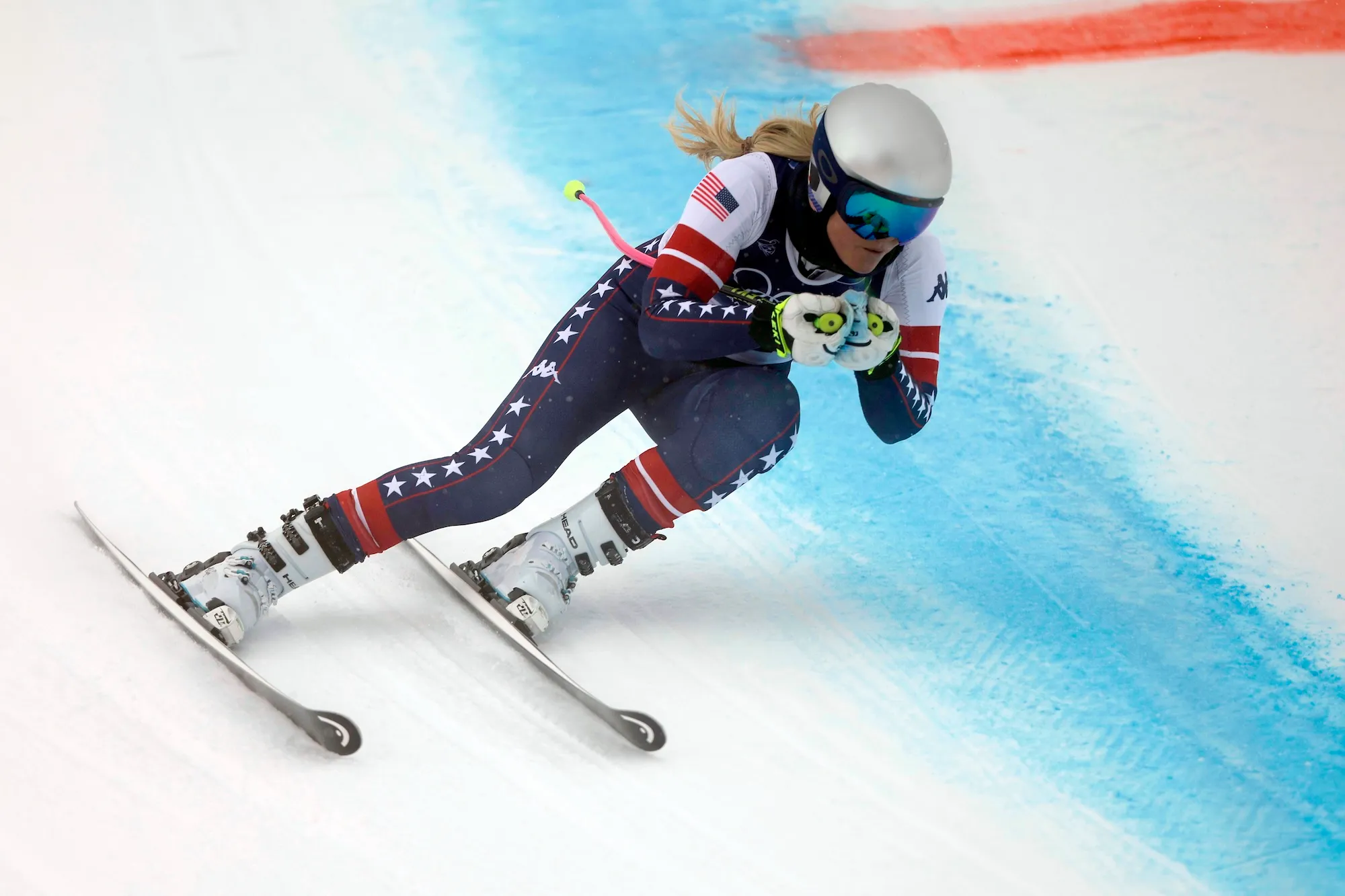 Lindsey Vonn Shares Update on Her Recovery Following 2026 Winter Olympics Crash, Says She Still Can’t Stand