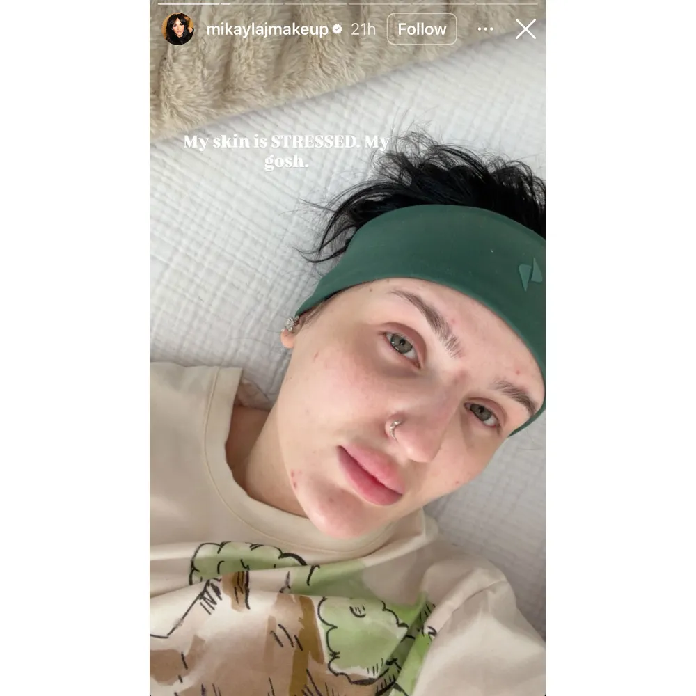 Influencer Mikayla Nogueira Shows Signs of Being Stressed Out After Announcing Divorce 2