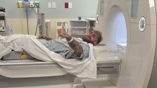 Jake Paul Jaw Surgery