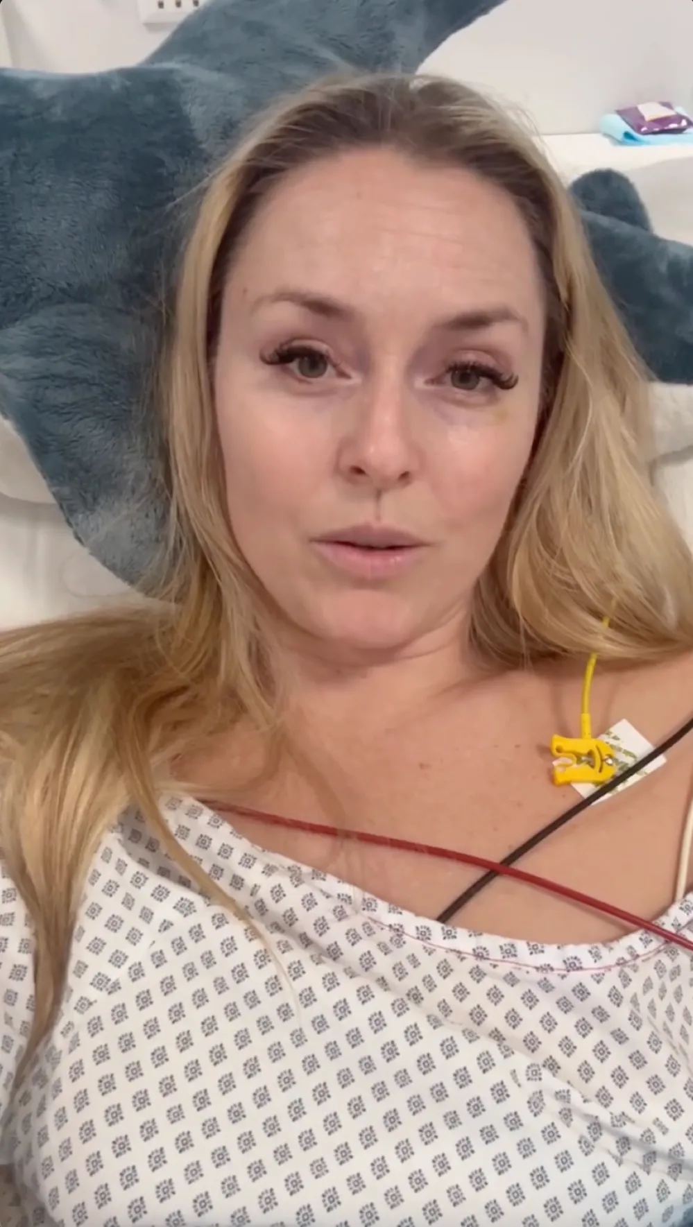 Lindsey Vonn Gives Says She Is Feeling More Like Myself Ahead of Another Surgery Following Olympic Crash Hospital