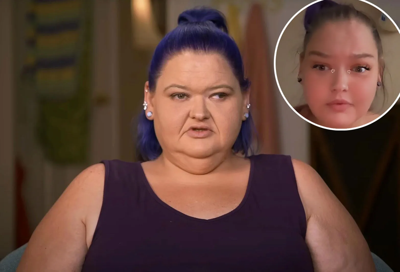 Promo Amy Slaton Shows Off Results After Surgery to Correct Her Lazy Eye