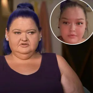 Promo Amy Slaton Shows Off Results After Surgery to Correct Her Lazy Eye