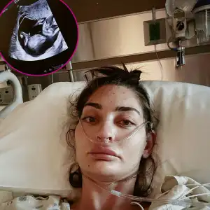 Promo Pregnant Influencer Shares Doctors Had to Stop Her Heart for 80 Minutes During Surgery