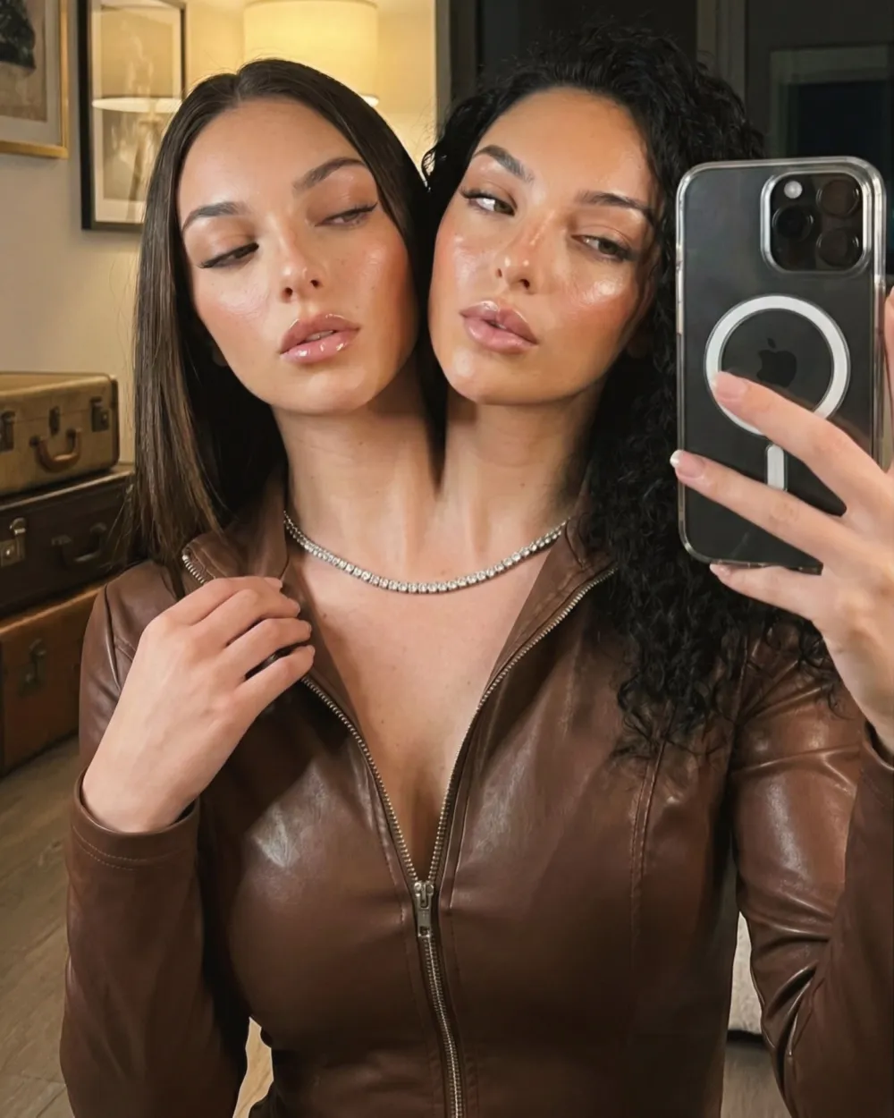 &iquest;Qui&eacute;nes son Valeria y Camila? La verdadera historia detr&aacute;s de las gemelas siamesas virales