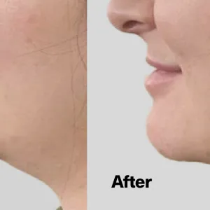 ShapeShift V-Line Jaw Defining Serum