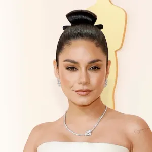 Vanessa Hudgens Shares Postpartum Hair Loss After Welcoming Baby No. 2