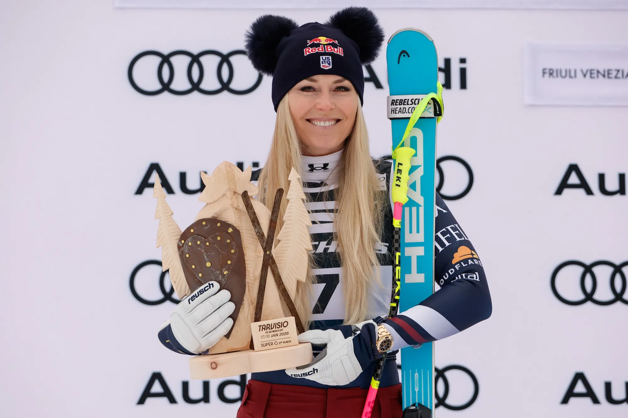 Lindsey Vonn Shows Off Bandaged Leg During Workout After 2026 Olympics Crash