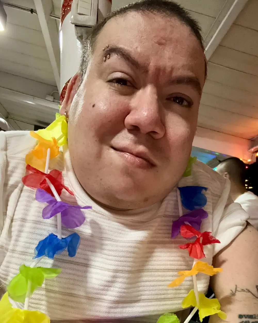 Influencer Alejo Little Dead at Age 33 After Sharing His Skeletal Dysplasia Journey With Fans Inline