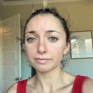 Influencer Brooklyn McKnight Shows Her Postpartum Hair Loss