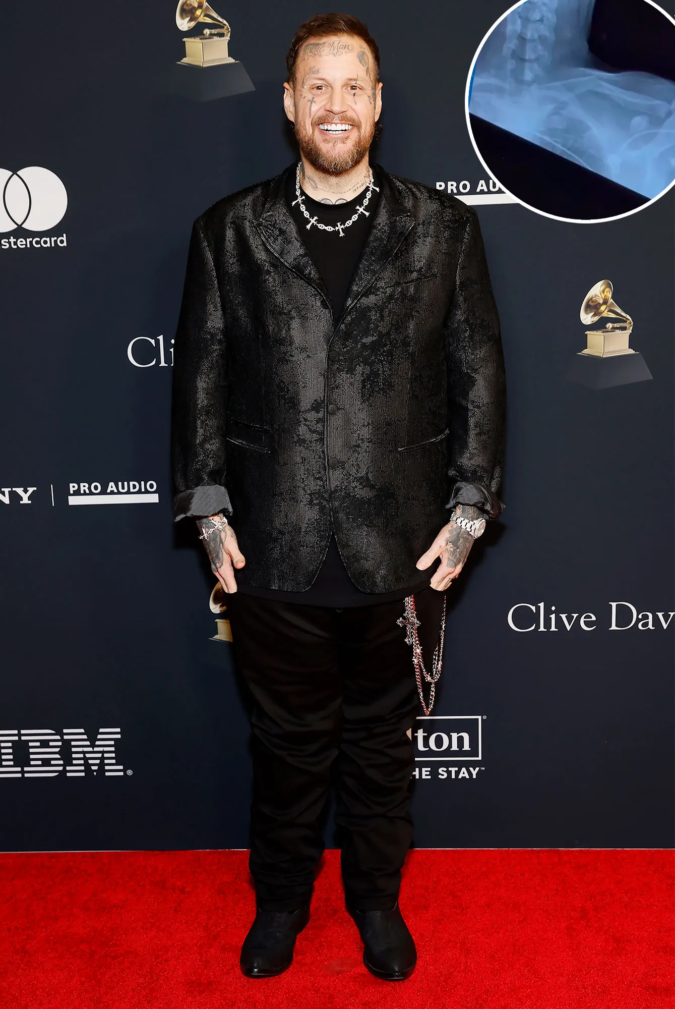 Promo Jelly Roll Reveals Secret Injury He Hid at the 2026 Grammys