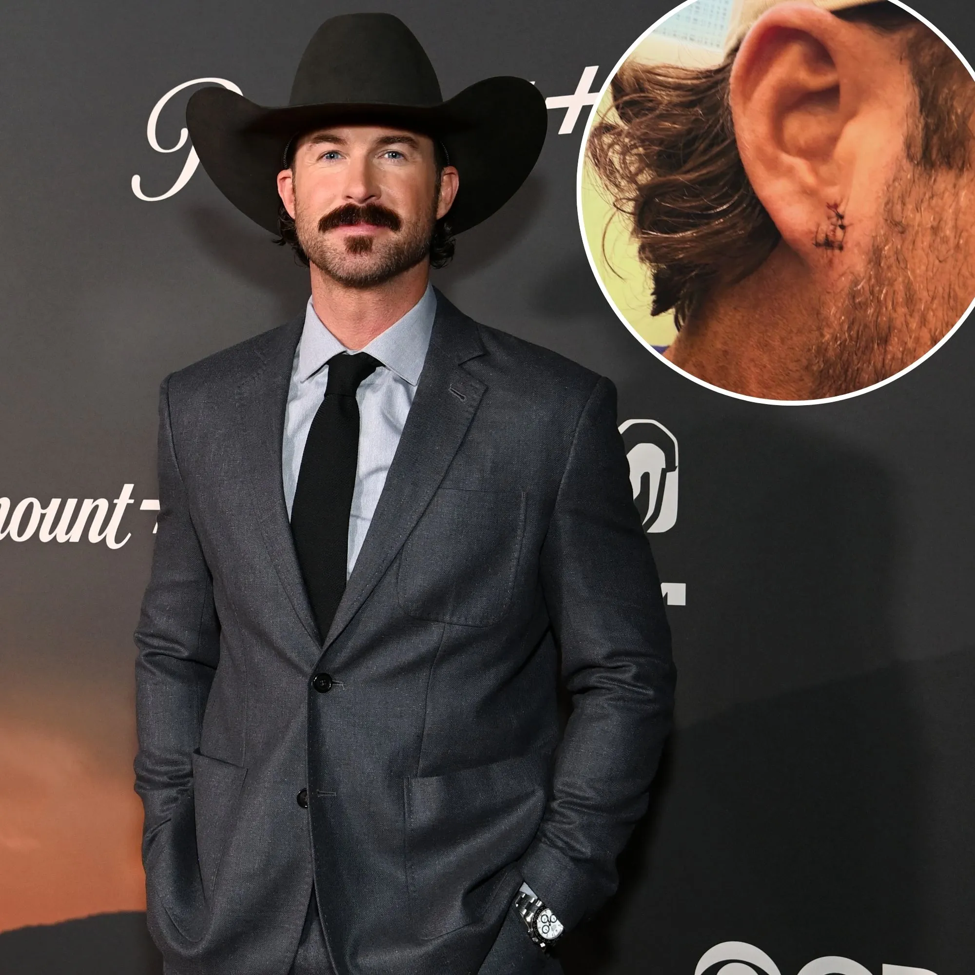 Riley Green Gets 5 Stitches After Fan Throws Phone at Him Makes Him Bleed Sewed Up