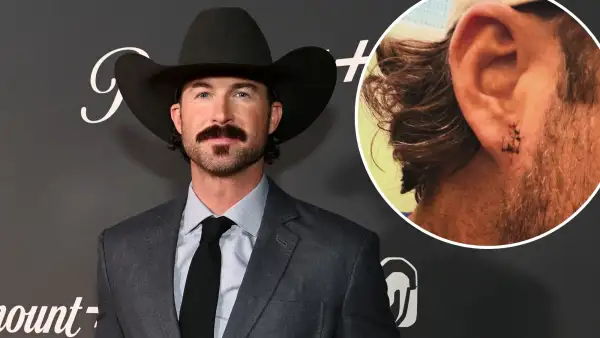 Riley Green Gets 5 Stitches After Fan Throws Phone at Him Makes Him Bleed Sewed Up