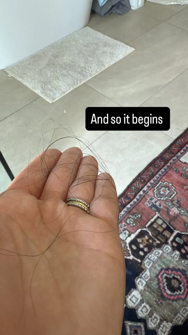 Vanessa Hudgens Shares Postpartum Hair Loss After Welcoming Baby No. 2